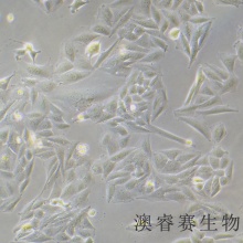 Saos-2（人成骨肉瘤细胞）