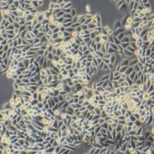 SiHa（人子宫颈鳞癌细胞）