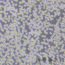 H22（小鼠肝癌细胞）