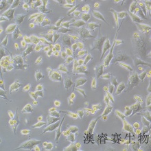 TT（人甲状腺导管癌细胞）