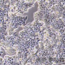 T47D（人乳腺导管癌细胞）