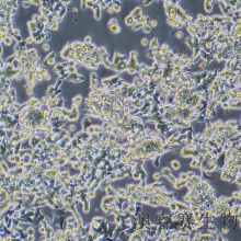 LoVo（人结肠癌细胞）