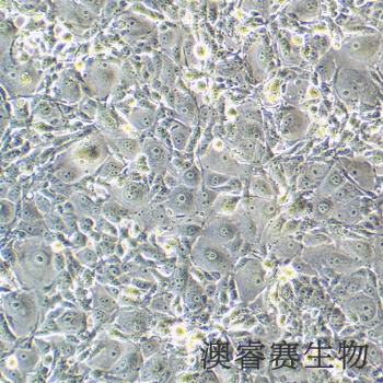 MDBK [NBL-1]（牛肾细胞）