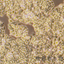Eca-109（人食管癌细胞）