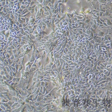 HCT-8 [HRT-18]（人回盲肠癌细胞）