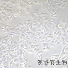 Hela（人宫颈癌细胞）