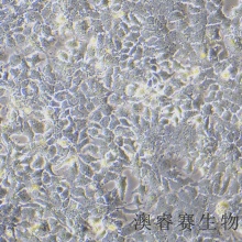 HuH-7（人肝癌细胞）