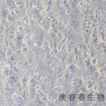 HuH-7（人肝癌细胞）