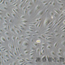 HUV-EC-C [HUVEC]（人脐静脉血管内皮细胞）