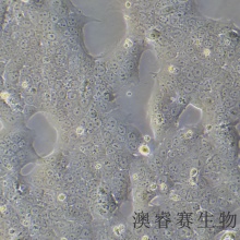 JEG-3（人绒毛膜癌细胞）