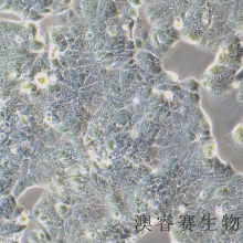 MCF7 [MCF-7]（人乳腺癌细胞）