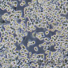 Neuro-2a [N2a; Neuro-2a]（小鼠脑神经瘤细胞）