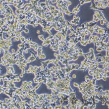 RL95-2（人子宫内膜癌细胞）