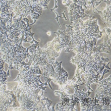 VCaP（人前列腺癌细胞）