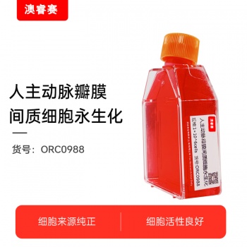 人主动脉瓣膜间质细胞永生化