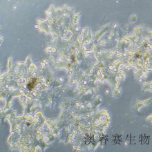 22RV1（人前列腺癌细胞）