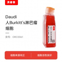 Daudi（人Burkitt's淋巴瘤细胞）
