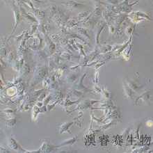 SV-HUC-1（人输尿管上皮永生化细胞）