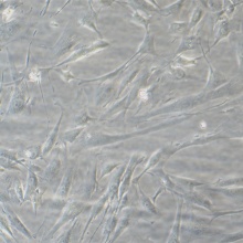 HEB（人脑胶质细胞株）