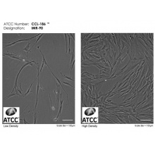 IMR-90（人胚肺成纤维细胞 有限细胞系）