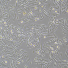 MDA-MB-231-luc（人乳腺癌细胞-荧光素酶标记）