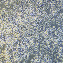 C666-1（人鼻咽癌细胞）