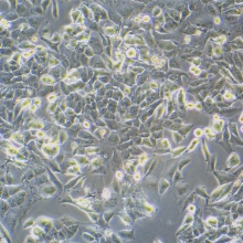 MHCC97-H（高转移人肝癌细胞）