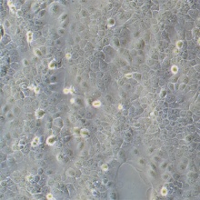 NHEK（正常人表皮角质形成细胞）