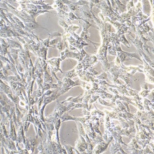 sNF96.2（人雪旺细胞神经纤维瘤病1型）