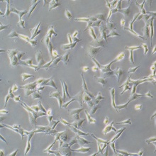 MC38-luc（小鼠结肠癌细胞-luc）