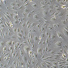 人淋巴管内皮细胞永生化