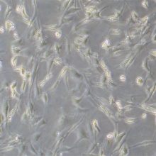 人主动脉瓣膜间质细胞永生化