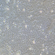 JHH7（人肝癌细胞）