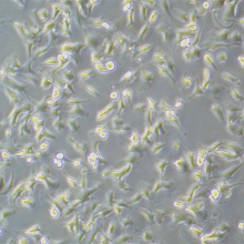 U251-LUC（人神经胶质细胞瘤细胞带荧光素酶）