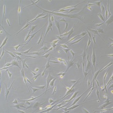 人子宫内膜上皮细胞永生化