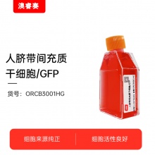 人脐带间充质干细胞/GFP