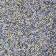 MC38小鼠结肠癌细胞