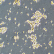 SNU-16人胃癌细胞