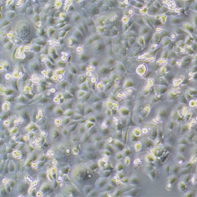 NCM460细胞；人正常结肠上皮细胞系