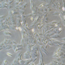 U-2OS 人骨肉瘤细胞
