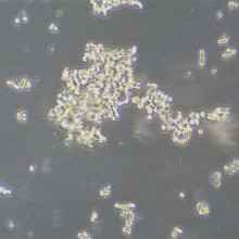 Y79（人视网膜母细胞瘤）