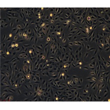 NP69（人永生化鼻咽上皮细胞）