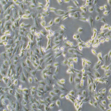 786-O（人肾透明细胞腺癌细胞）