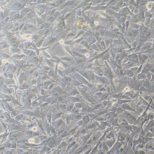 A172（人胶质母细胞瘤细胞）