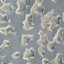 BT-474 [BT474]（人乳腺导管癌细胞）