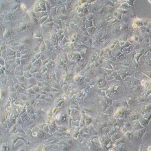 Caco-2（人结直肠腺癌细胞）