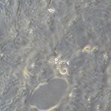Calu-3（人肺腺癌细胞（胸水））