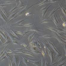 CCD-1095Sk（人乳腺浸润性导管癌旁皮肤细胞）