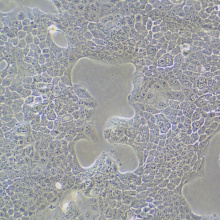 HCC827（人非小细胞肺癌细胞）