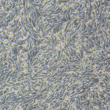 HFL1（人胚肺成纤维细胞）